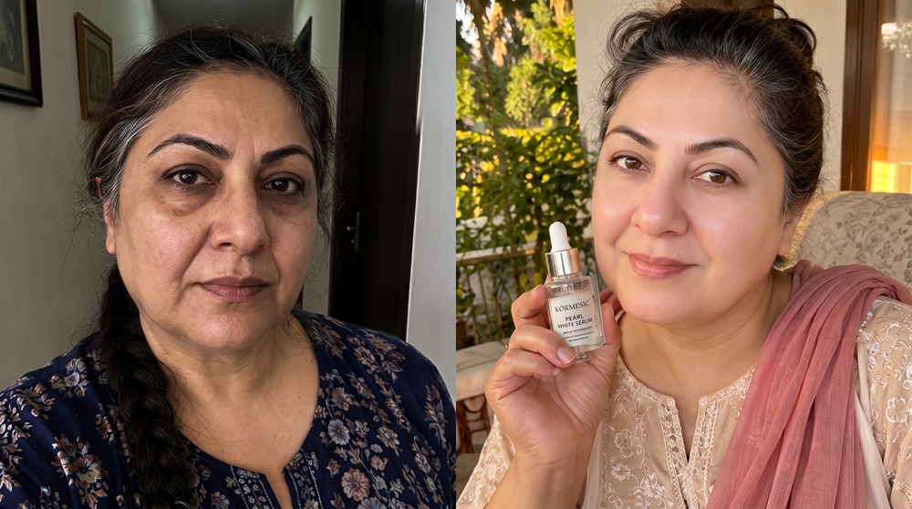 Illustrative before and after skin appearance example